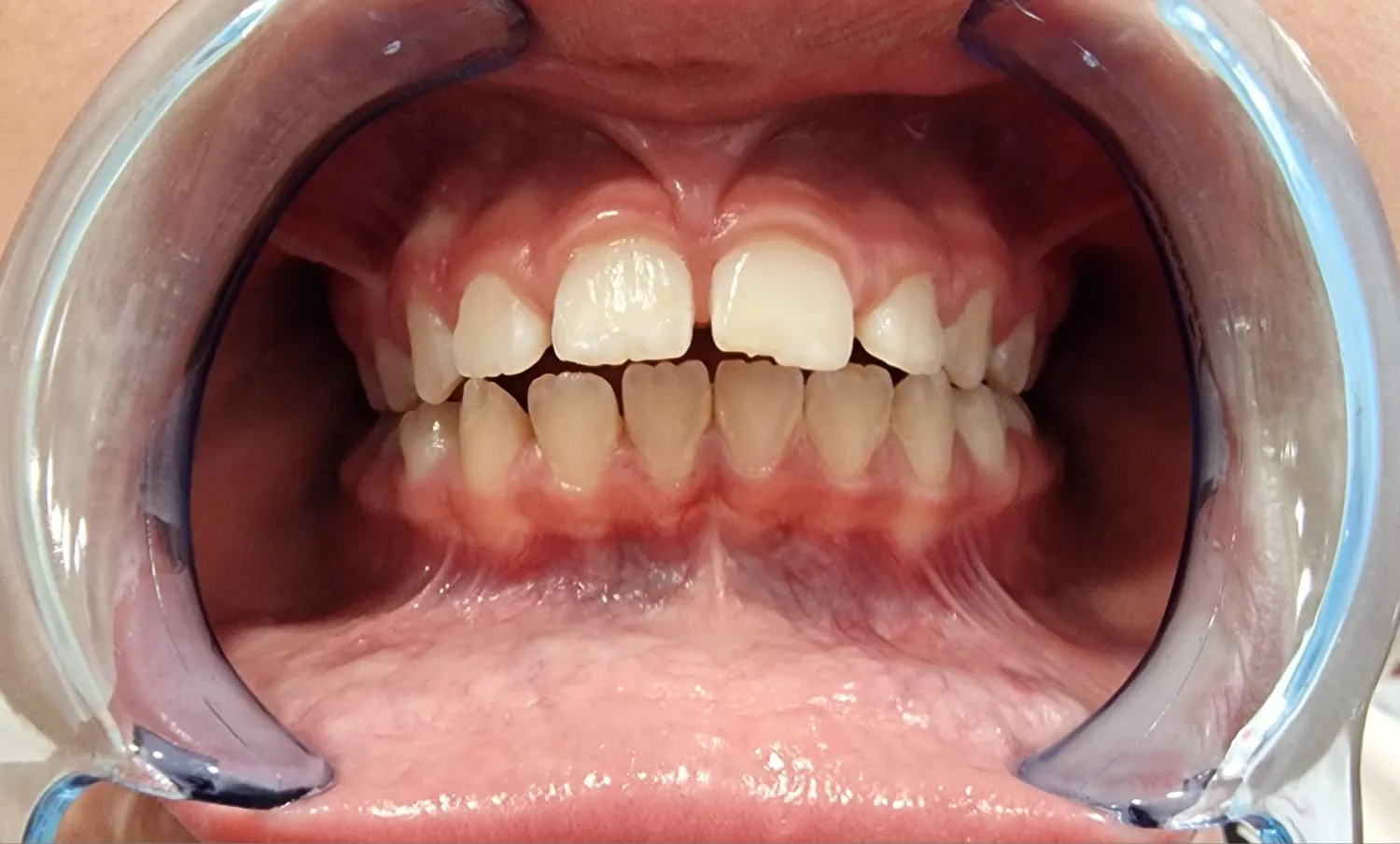 Imagen representativa de Motricidad Orofacial